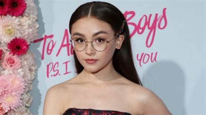 Anna Cathcart’s Teeth: What About The Gaps Between Them?