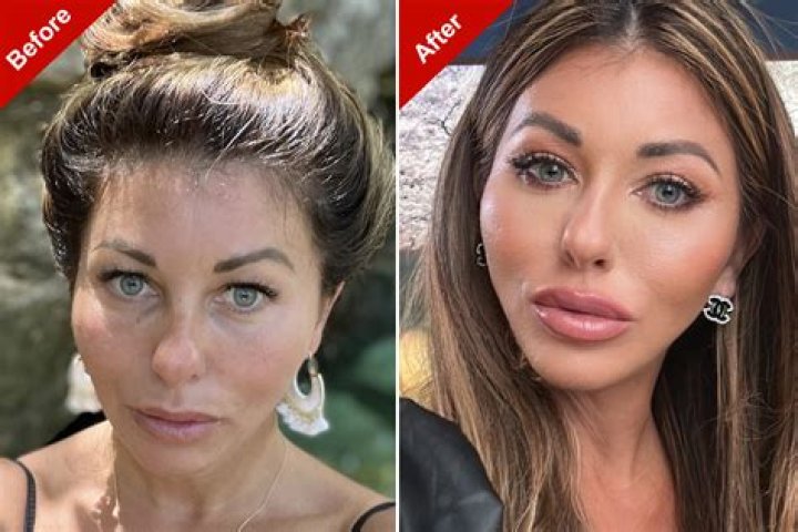 
Has Sondra Theodore Undergone Plastic Surgery? Hugh Hefner Ex Girlfriend Grooming Allegations And More 