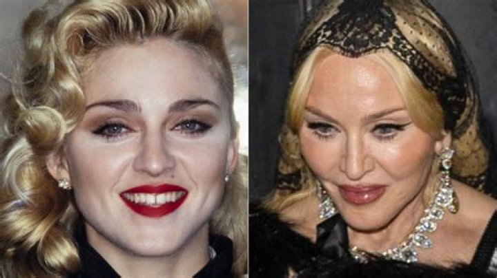 How many No 1 Has Madonna had? How many Grammys does Madonna have?