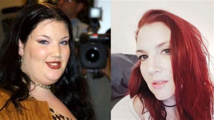 Ivy Snitzer’s Weight Loss: Know How Lap Band Surgery Left Her Starve to Death!