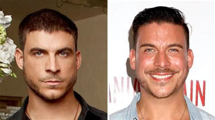 Jax Taylor’s Plastic Surgery: Nose Job Examined With Before and After Pictures!