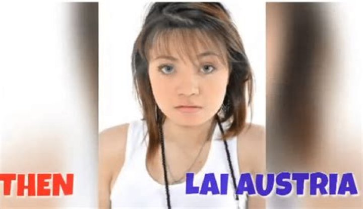Lai Austria Real Gender: Before And After Surgery