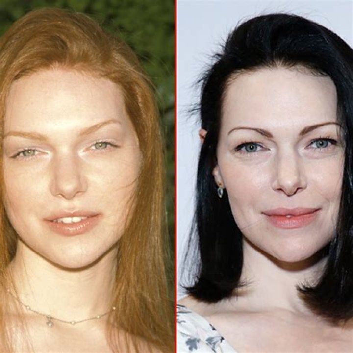 Laura Prepon Teeth Before And After Along With Plastic Surgery Details