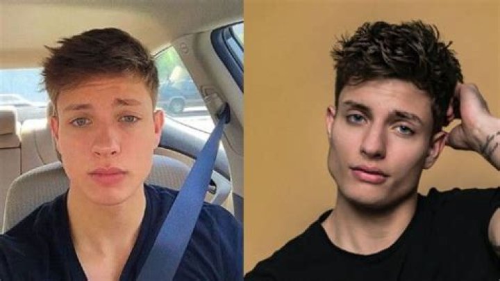 Matt Rife’s Plastic Surgery: Did The Comedian Have a Glow-Up or Did He Get Cosmetic Procedures? Check Out His Before and After Pictures!