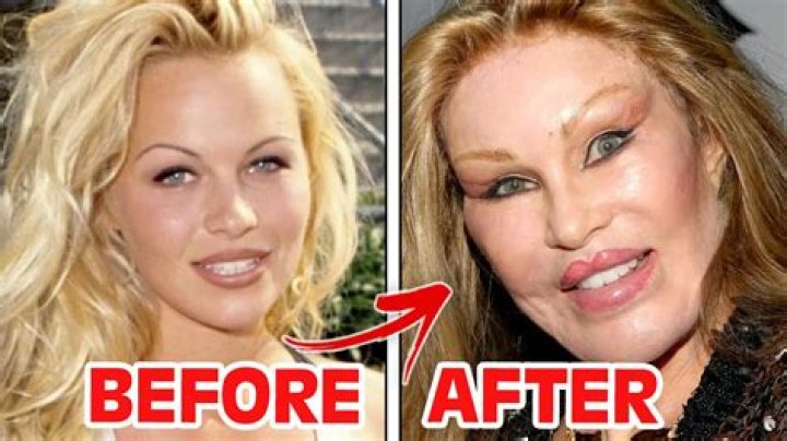 Sidney Starr Before and After Surgery Pictures: Real Name and Net Worth
