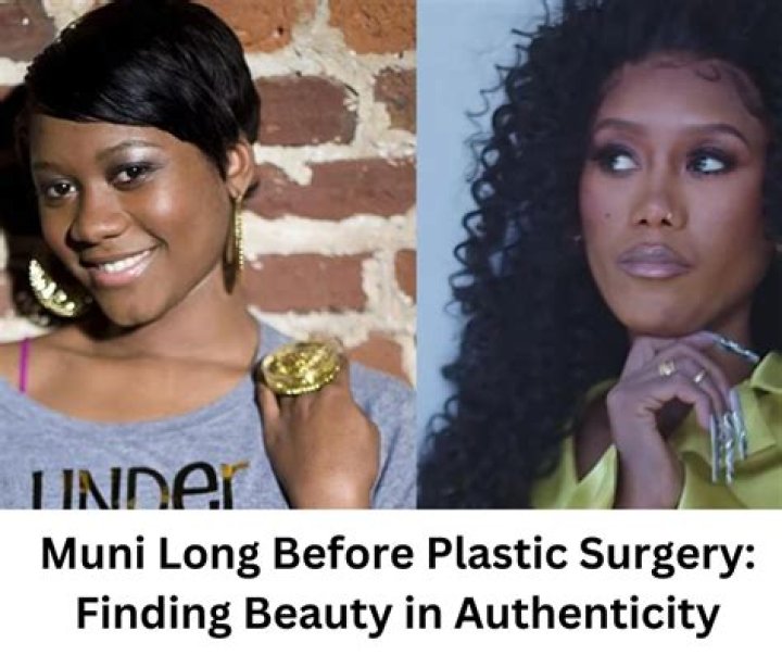Surgery: Did Muni Long Undergo Nose Job? Before And After Photos And Parents Race