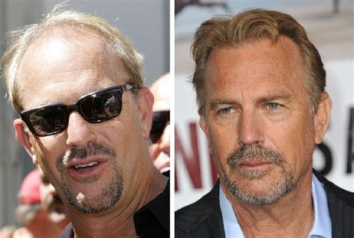What Happened To Kevin Costner’s Left Ear, Is He Battling Cancer?