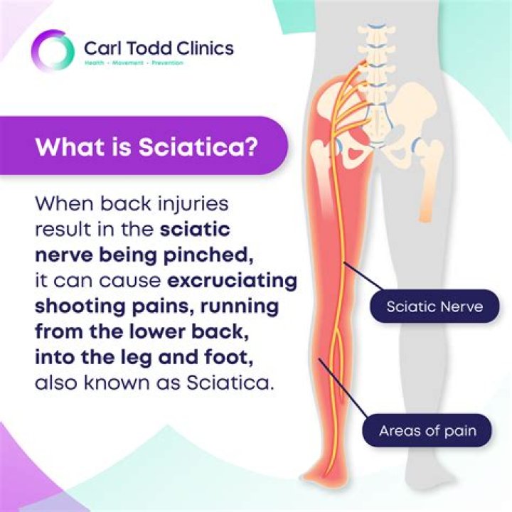 
What is sciatica? Adele health problems explored as singer opens up on painful condition 