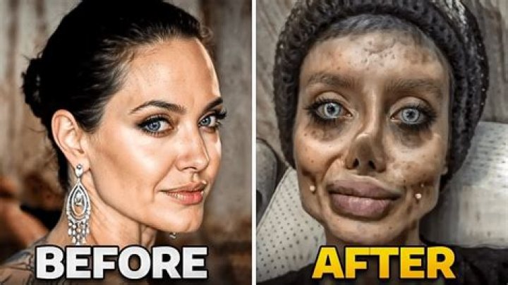Where Has Gloria Borger Been? Details On Plastic Surgery And Illness