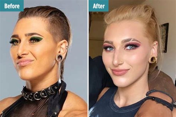 WWE Star Rhea Ripley No Makeup Look: Plastic Surgery Before And After